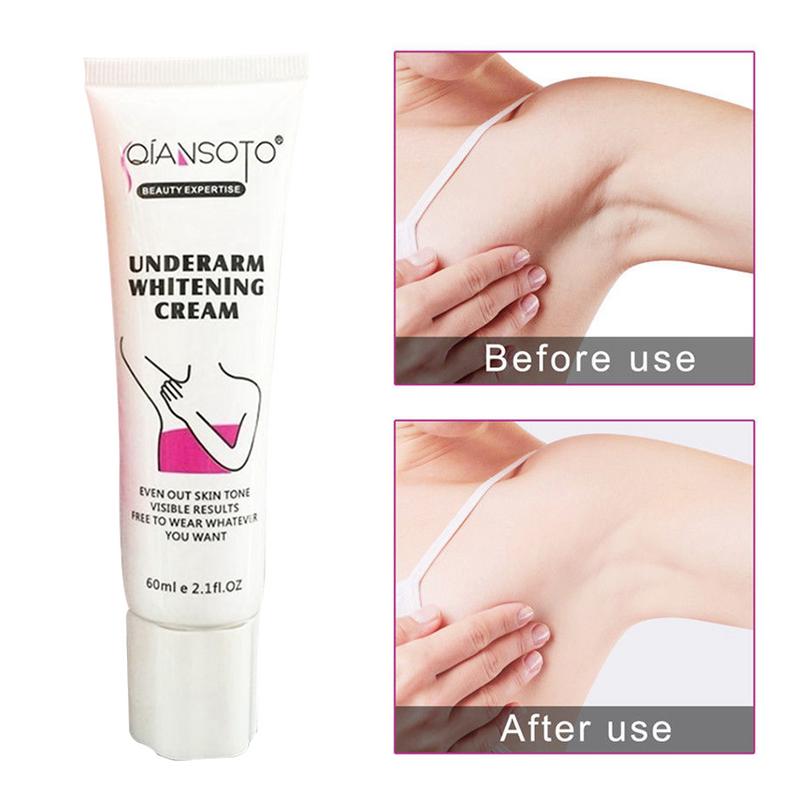 Body Whitening Underarm Knee Dark Spot Cream 60g Skin Pigmentation Dark Spot Corrector Antiperspirant Armpit Odor Remover Lotion